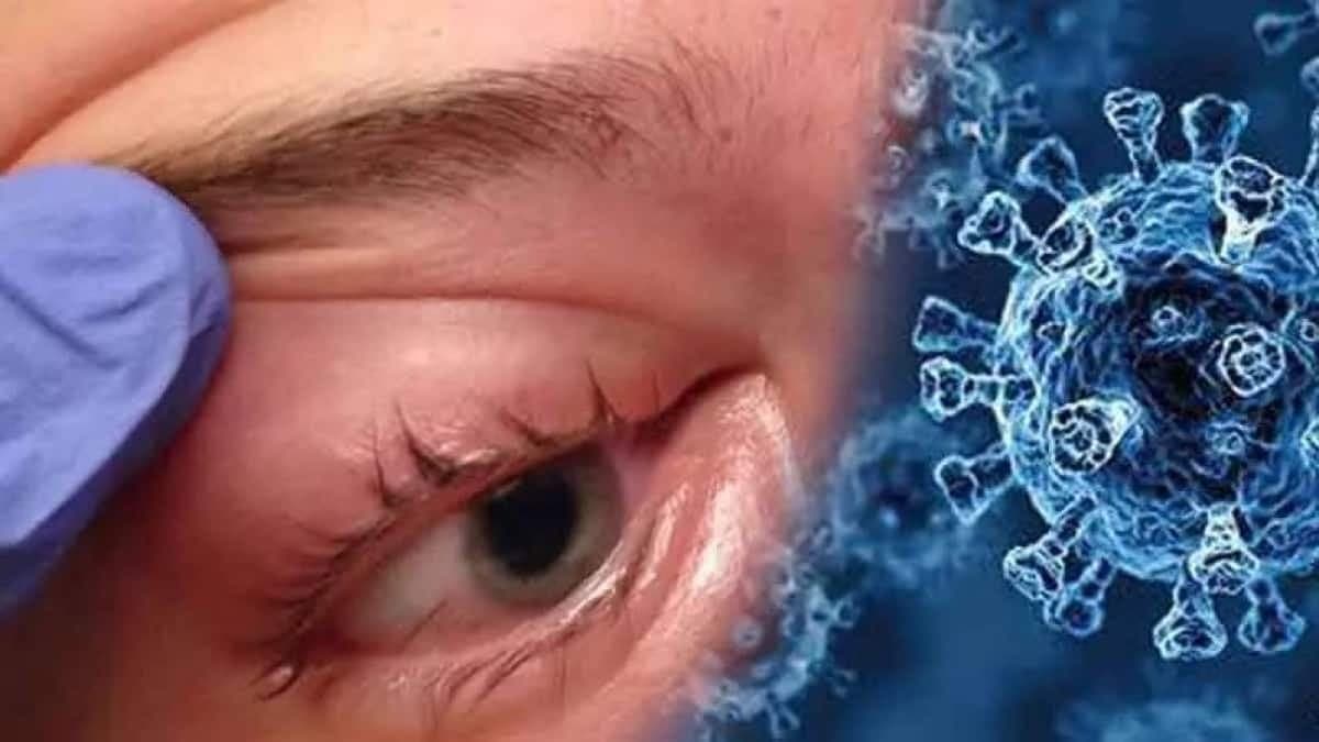 रायसेन: सामने आए ब्लैक फंगस के दो मरीज, एक की मौत एक स्वस्थ होकर घर लौटा