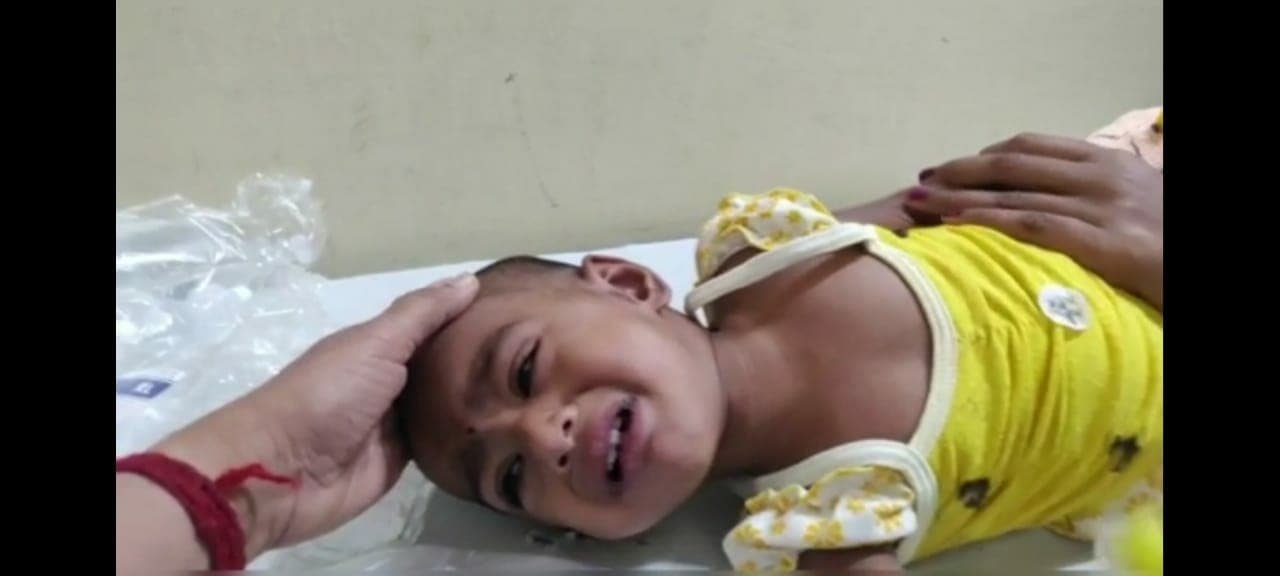 मिर्ची का टुकड़ा पड़ा मासूम की सांसों पर भारी, मुश्किल से बची जान