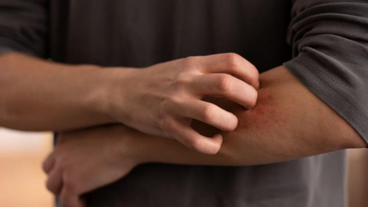 हिवाळ्यात त्वचेची अॅलर्जी होऊन सतत खाज सुटतेय? ‘हे’ घरगुती उपाय देतील आराम