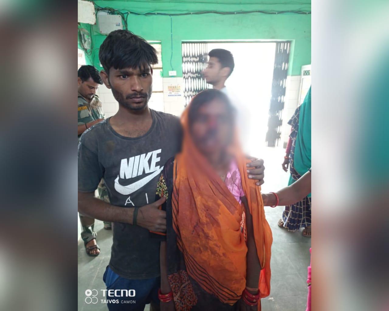घरेलू विवाद में पति ने पत्नी की काटी नाक, घटना के बाद आरोपी फरार