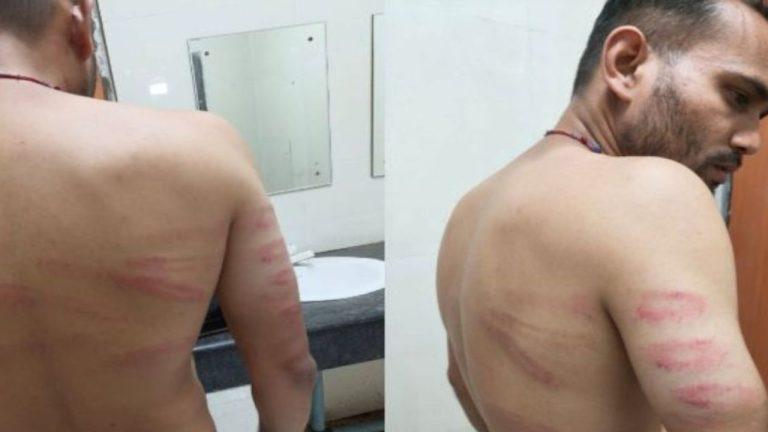 जबलपुर में अमरनाथ रजिस्ट्रेशन के दौरान बवाल, लाइन में खड़े युवक की पिटाई