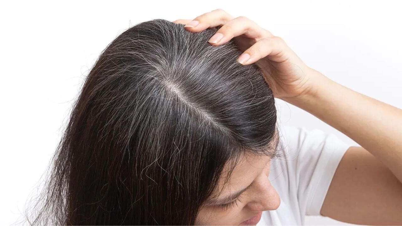 कोणत्या व्हिटॅमिन्सच्या कमतरतेमुळे केस पांढरे होतात? जाणून घ्या काय-काय खावे