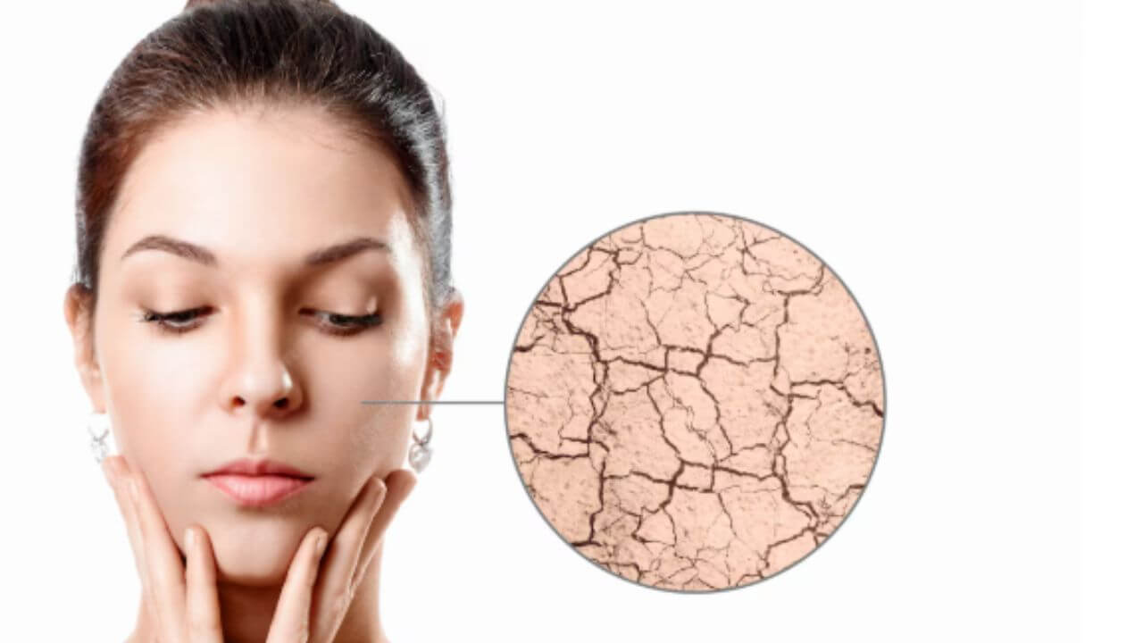 थंडीमुळे चेहऱ्याची त्वचा कोरडी होऊन खडबडीत झालीय? मग करा 'हे' घरगुती उपाय