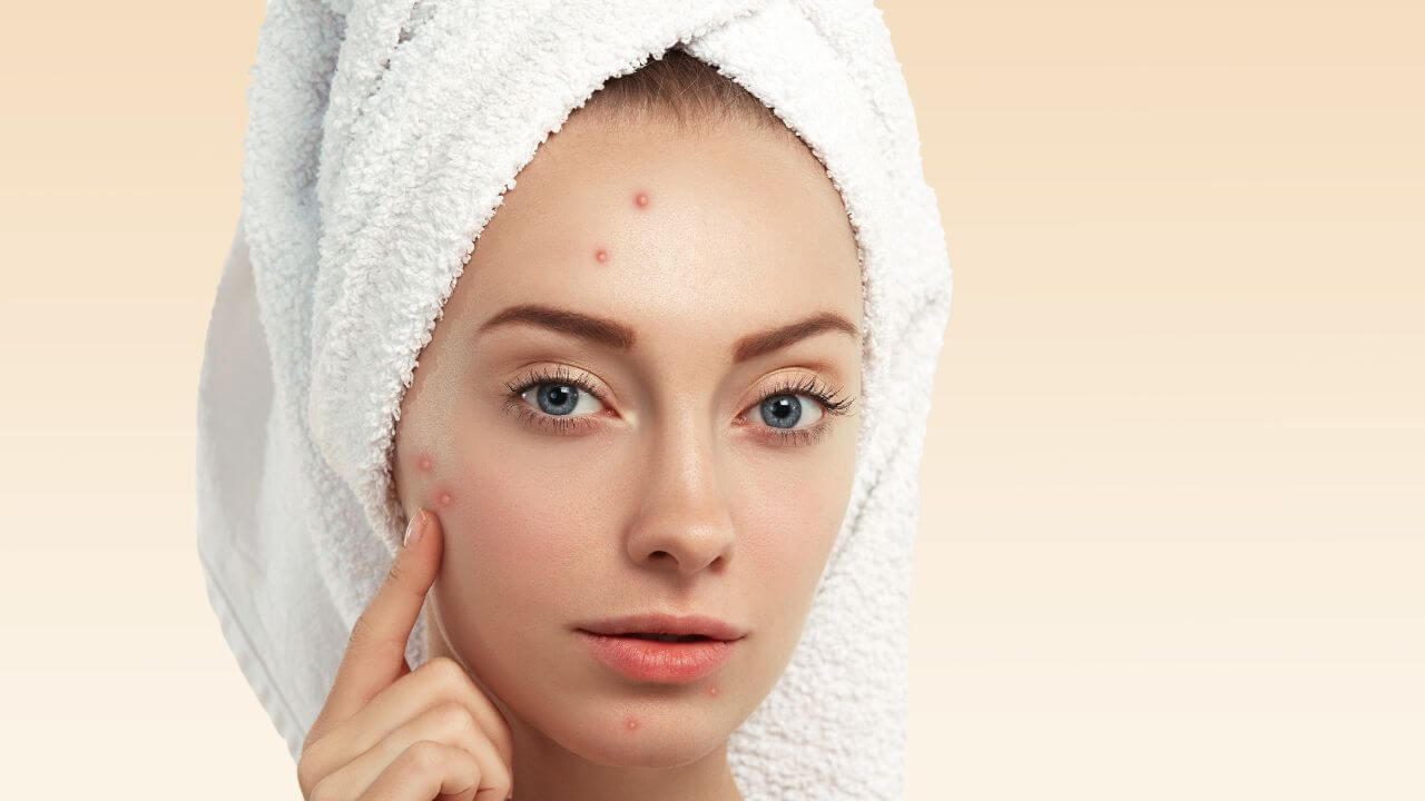 पिंपल्स दूर करण्यासाठी प्या 'हे' ३ घरगुती ड्रिंक, चेहरा होईल गुळगुळीत आणि चमकदार