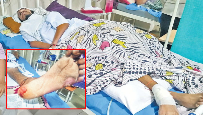 ratlam-news-rats-bite-patient-foot-in-government-hospital-admitted-in-icu-