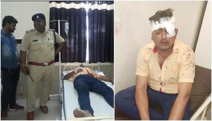 voting-bjp-councillor-injured-after-scuffle-broke-out-between-congress-and-bjp-workers-in-sagar
