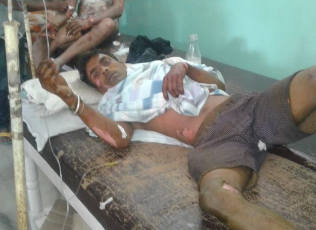 cyclinder-blast-in-ashoknagar-one-injured-badily