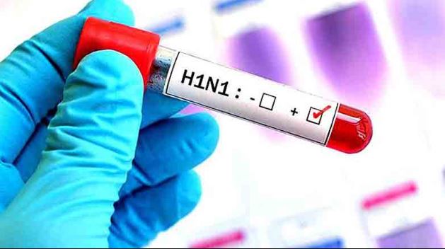 -Patients-with-these-diseases-have-swine-flu-so-it-is-difficult-to-save-life-