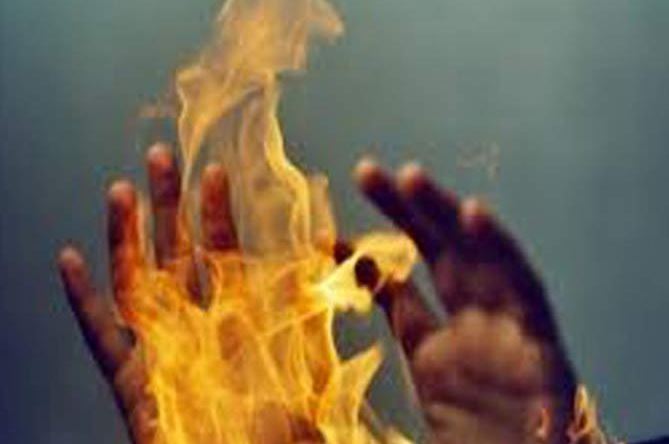गुना में दिवाली पर महिला गंभीर रुप से झुलसी, ससुराल पर जिंदा जलाने का आरोप