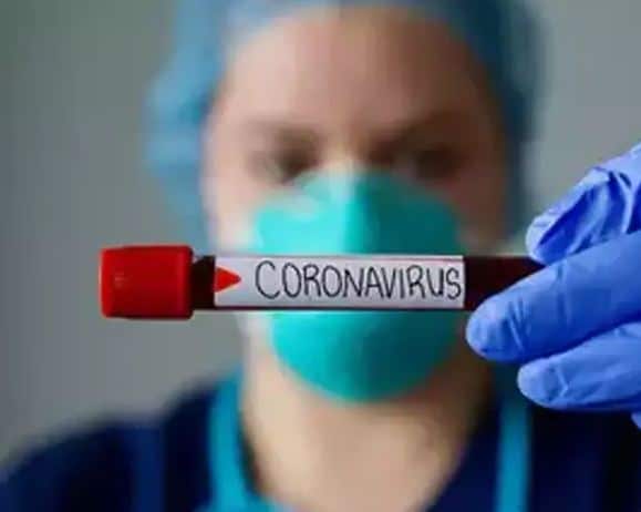 Corona update: एक ही दिन में मिलें 62 कोरोना पॉजिटिव, प्रदेश में संक्रमितों का आंकड़ा 392 पहुंचा