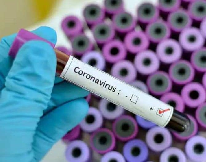 Bhopal Coronavirus: इंदौर से ज्यादा बिगड़े हालात, फिर 63 कोरोना पॉजिटिव