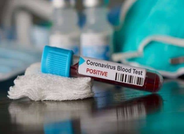 Indore Corona Virus: इंदौर में 21 की रिपोर्ट फिर पॉजिटिव, 4 की मौत, चिंता में प्रशासन