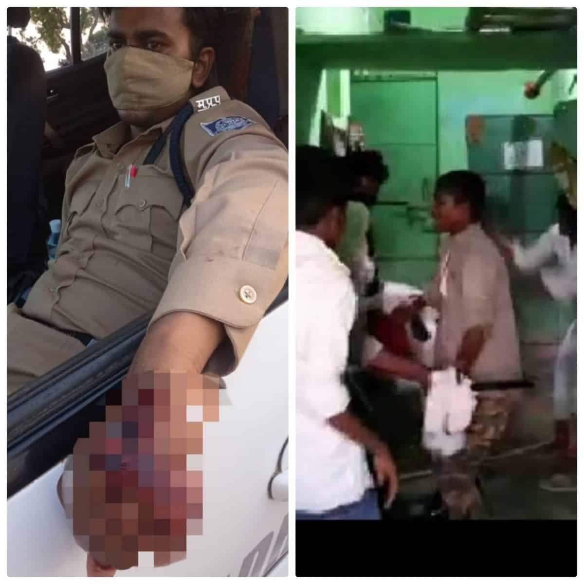 छतरपुर में कोरोना कर्फ्यू का पालन कराने पहुंची पुलिस पर भीड़ ने किया हमला, आरक्षक को जमकर पीटा