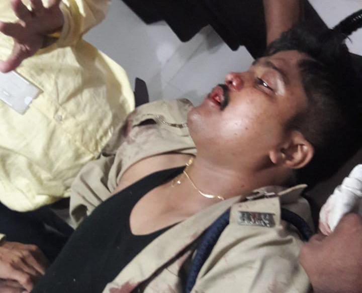 Burhanpur News: सड़क हादसे में प्रशिक्षु DSP रोहित राठौड़ गंभीर घायल, ICU में भर्ती