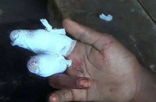 Damoh news: मन्नत पूरी होने पर युवक ने उंगली काटकर देवी को चढ़ा दी