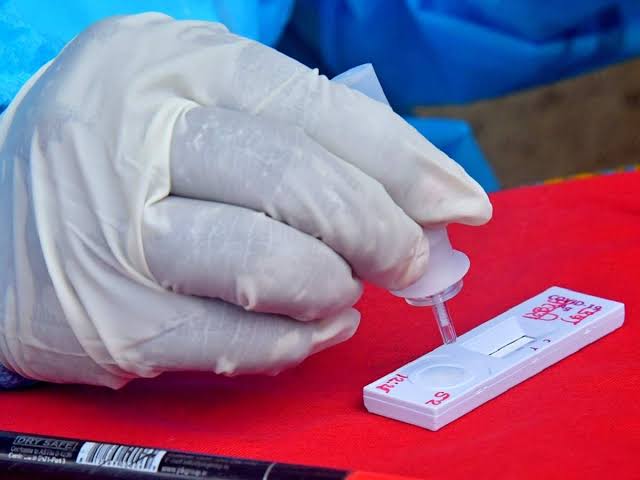 Rajasthan Rapid Antigen Covid Test: राजस्थान में कोविड-19 की रैपिड एंटीजन जांच मात्र 50 रुपए में