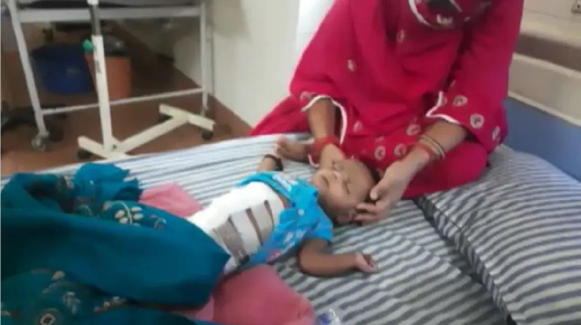 बिहार : जब 40 दिन के बच्चे के पेट में दिखा भ्रूण, सफल ऑपरेशन कर निकाला