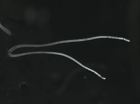 Thiomargarita magnifica : अब तक के सबसे बड़े बैक्टीरिया की हुई खोज, बिना माइक्रोस्कोप के भी आएगा नज़र