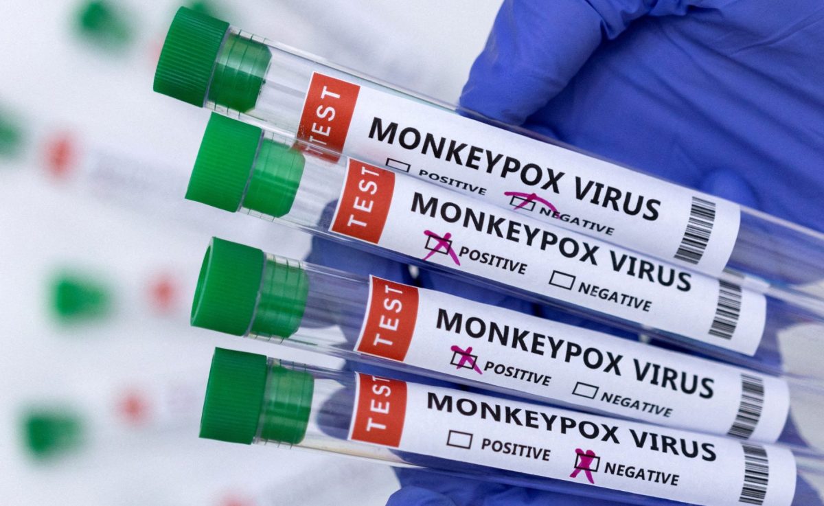 देश में बढ़ रहा Monkeypox का खतरा, इंदौर की महिला में दिखें इस वायरस के लक्षण! यहाँ जानें पूरा मामला