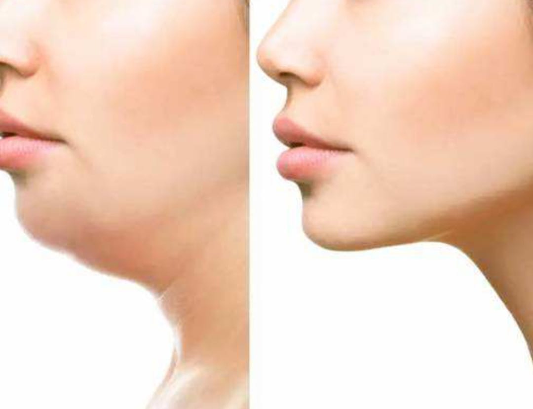 Double Chin Reducing Tips