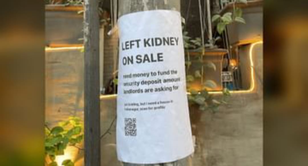 Kidney On Sale