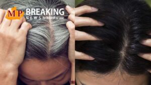 Hair problem: क्या सफेद बाल उखाड़ने से बड़ती है सफेदी? जानें क्या है इसका सच