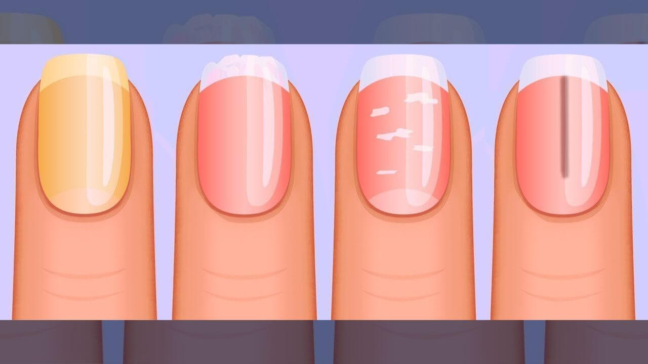 Nail Health