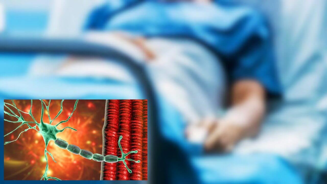 Guillain Barre Syndrome